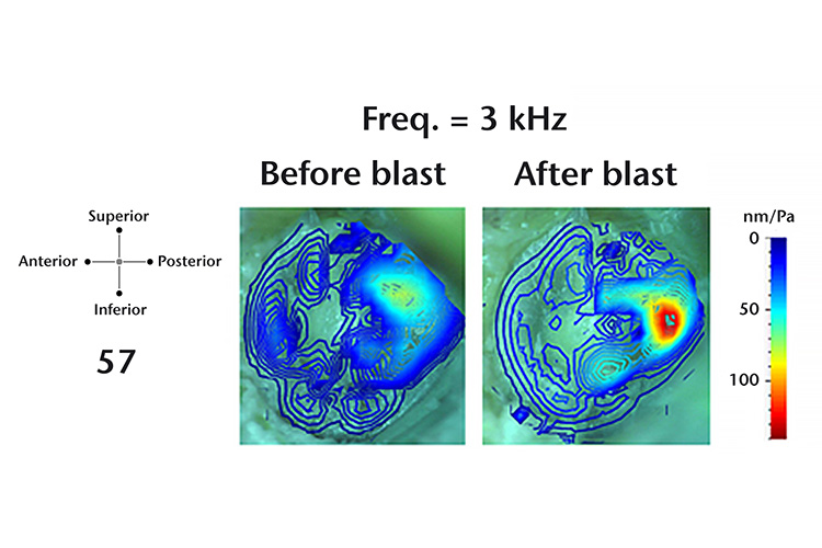 Example tympanic membrane deflection shape (3 kHz) before and after blast exposure