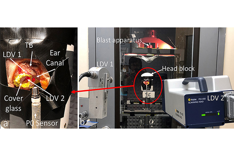 Real-time measurement of the stapes footplate movement during blast using two vibrometers